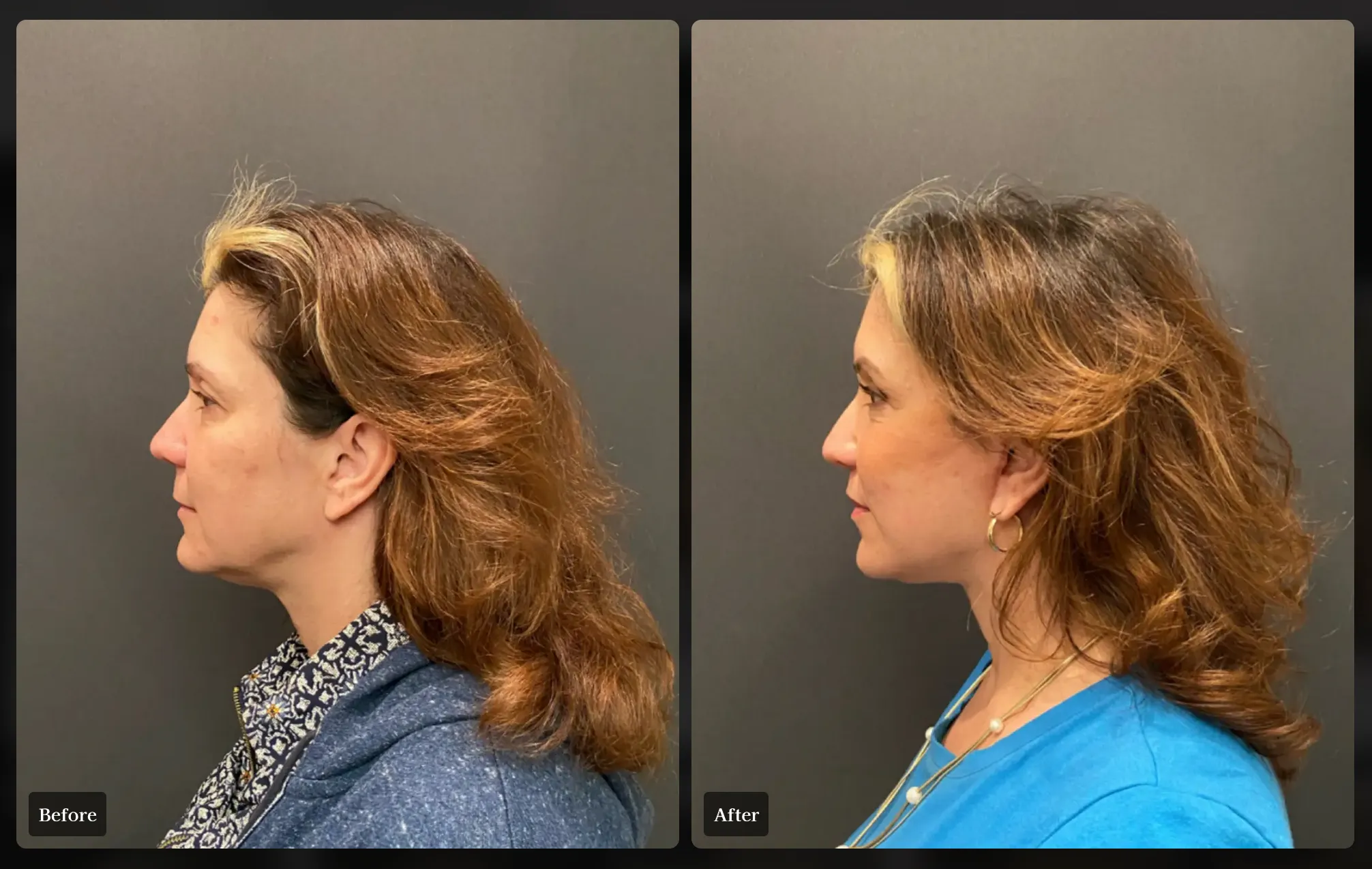 Sacramento Facial Surgery Procedures